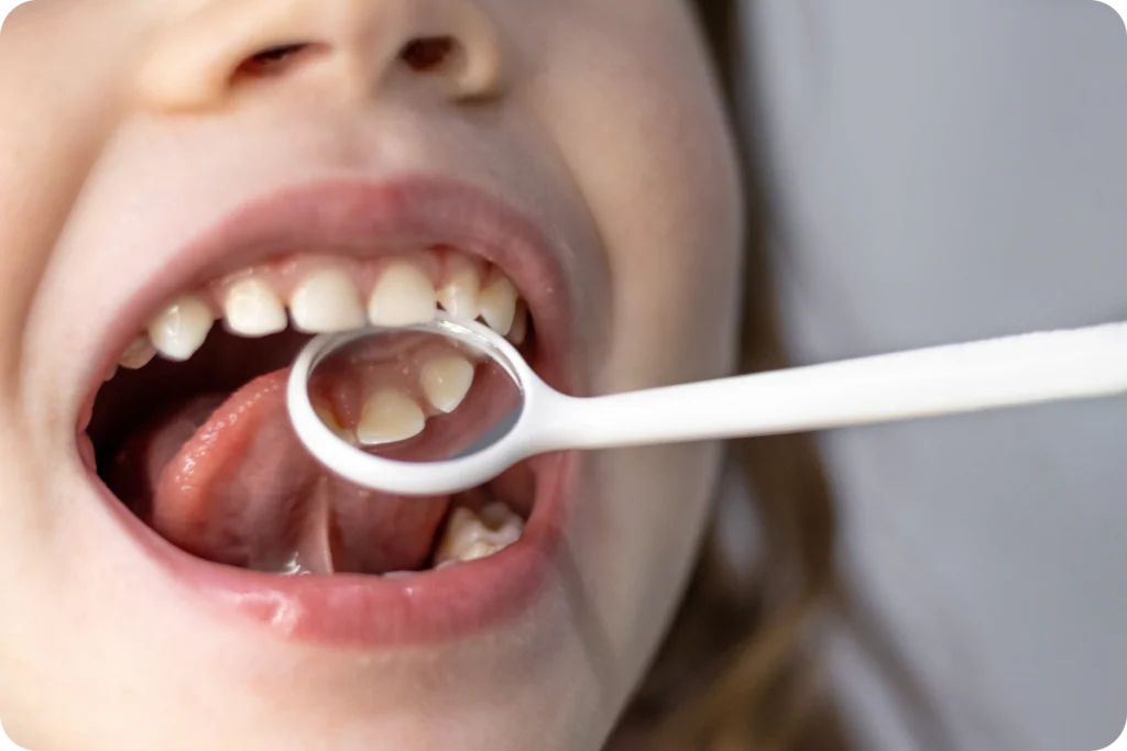 adobestock Soins dentaires chez l’enfant SNT, Dentistes à Vaires-sur-Marne