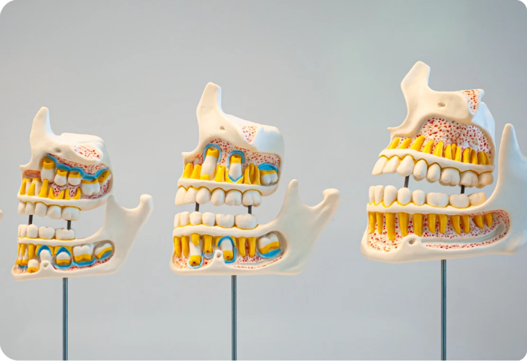 apparition dents lait Soins dentaires chez l’enfant SNT, Dentistes à Vaires-sur-Marne