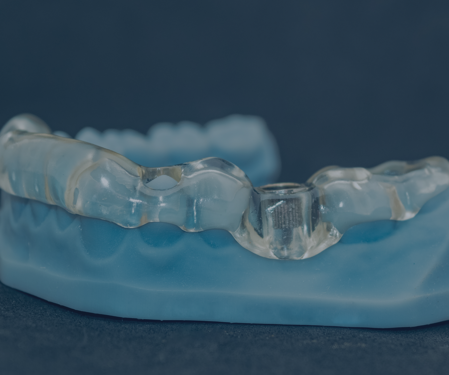 Nos technologies SNT, Dentistes à Vaires-sur-Marne