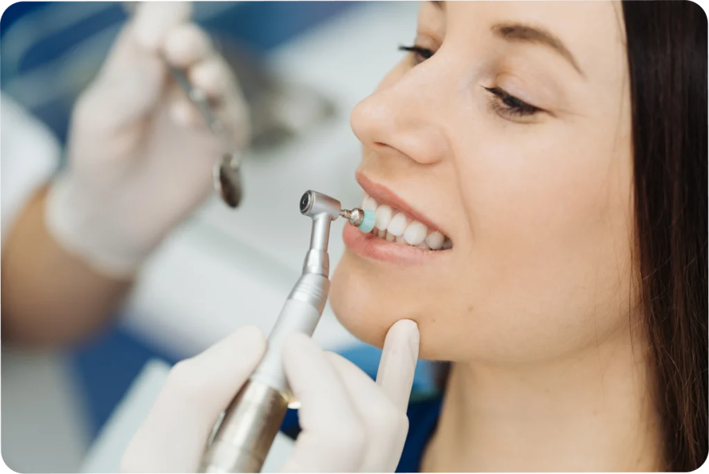 facettes dentaire ceramique vaires sur marne Facettes dentaires SNT, Dentistes à Vaires-sur-Marne