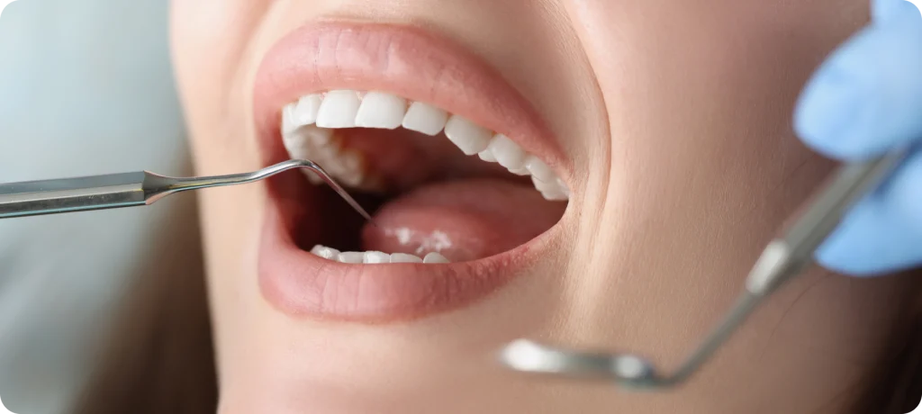 greffe osseuse preparation vaires sur marne Greffe osseuse SNT, Dentistes à Vaires-sur-Marne