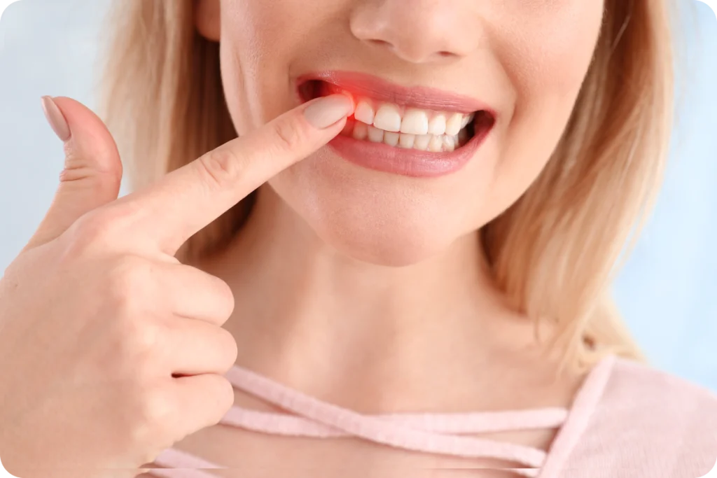 maladies gencives prevention quotidienne Traitement des maladies des gencives SNT, Dentistes à Vaires-sur-Marne