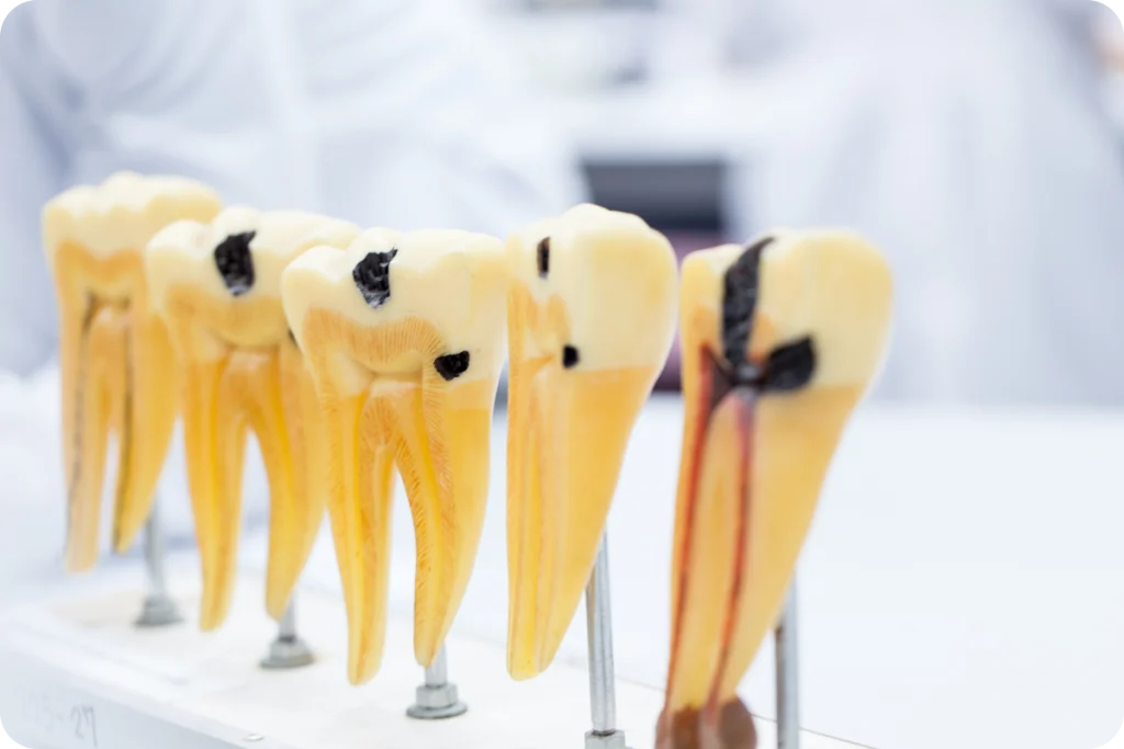 soins esthetiques restaurateurs dents vaires sur marne Soins esthétiques restaurateurs SNT, Dentistes à Vaires-sur-Marne