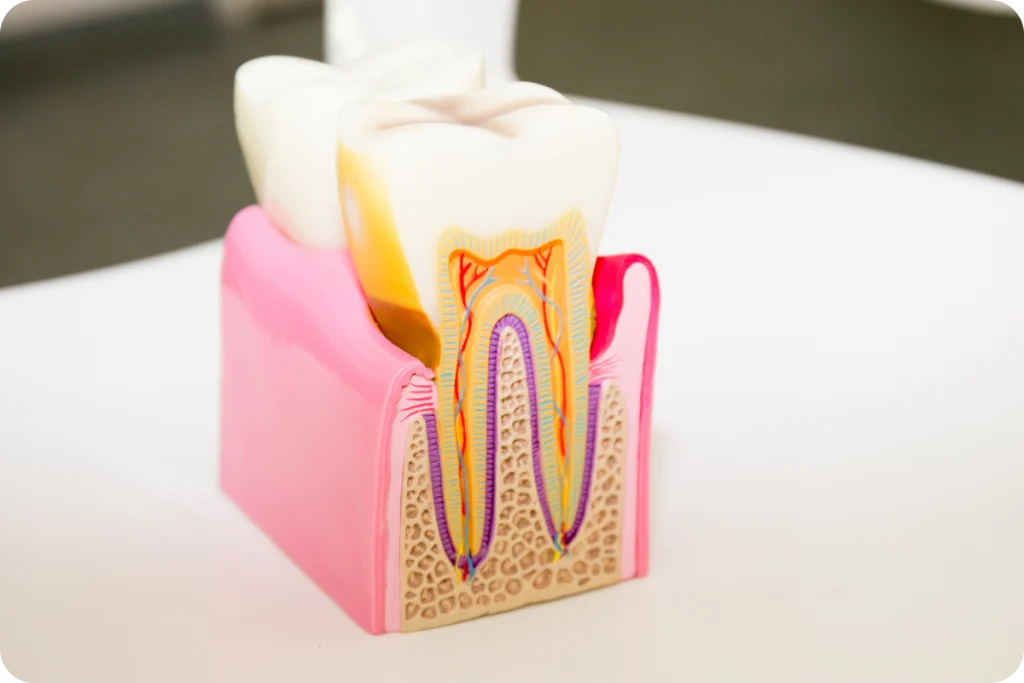 traitement endodontique racine vaires sur marne Traitement endodontique SNT, Dentistes à Vaires-sur-Marne