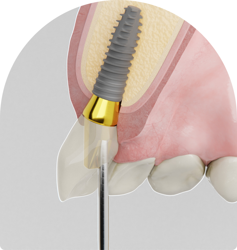 SNT, Dentistes à Vaires-sur-Marne